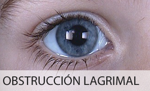 Obstrucción Lagrimal‏